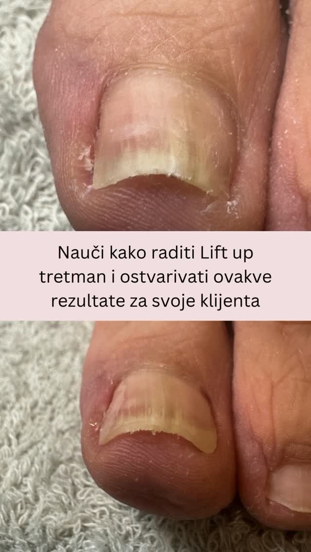 Instagram post from liftup_bosna_i_hercegovina. This post is in position 2.