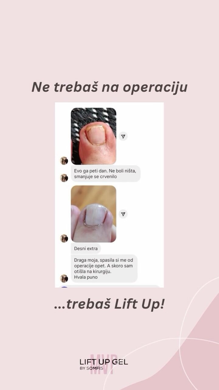 Instagram post from liftup_bosna_i_hercegovina. This post is in position 4.