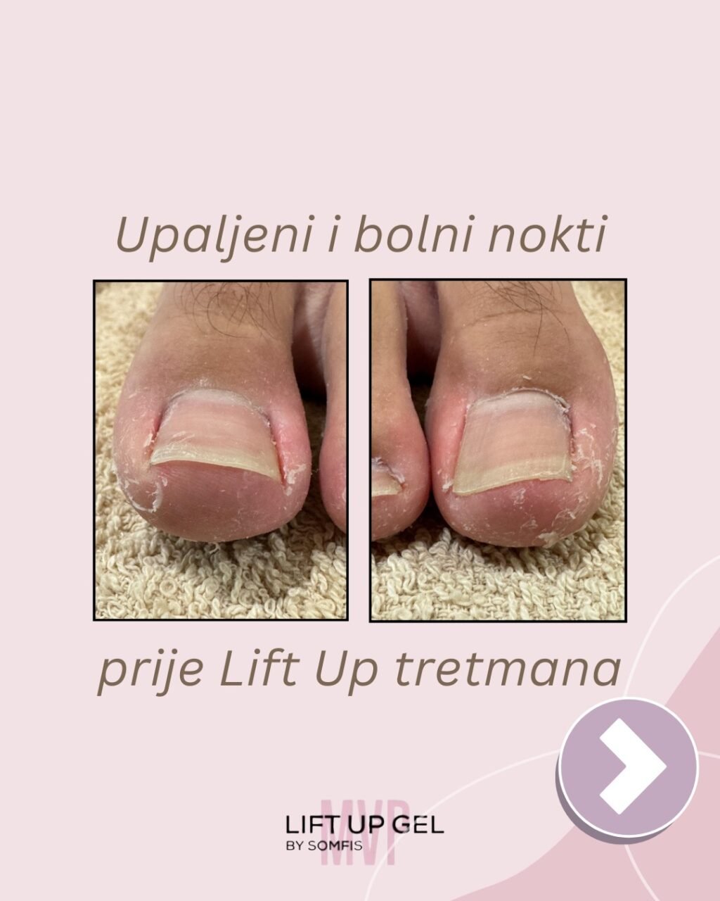 Instagram post from liftup_bosna_i_hercegovina. This post is in position 0.